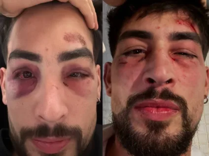 Empresário gay denuncia agressão de seguranças em karaokê no centro de SP