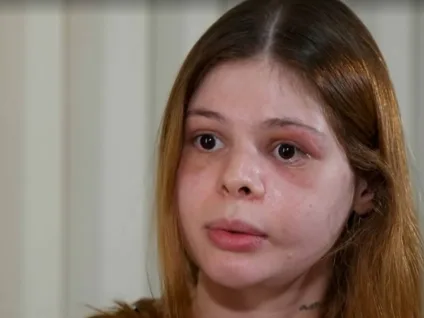 Médica diz que foi agredida pelo ex-namorado após ciúmes em balada LGBT