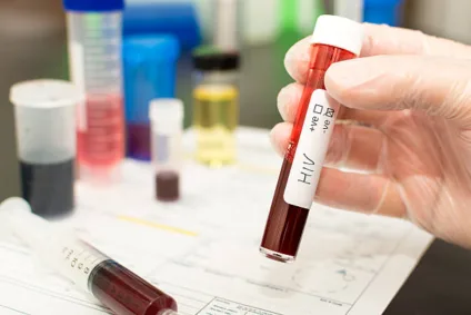 Governo de Fiji declara surto nacional de HIV diante de aumento de infecções