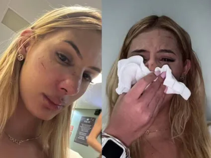 Jovem trans denuncia agressão em adega no interior paulista: "Não conheço ele"