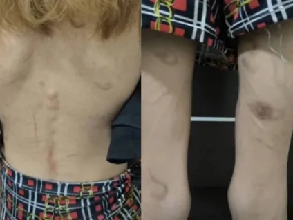 Trisal é detido por tortura e cárcere de adolescente de 16 anos em Goiânia