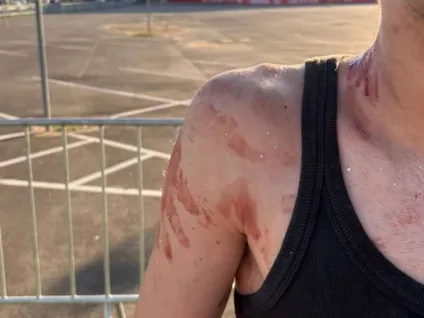 Motorista de aplicativo é indiciado por homofobia e agressões em Porto Alegre