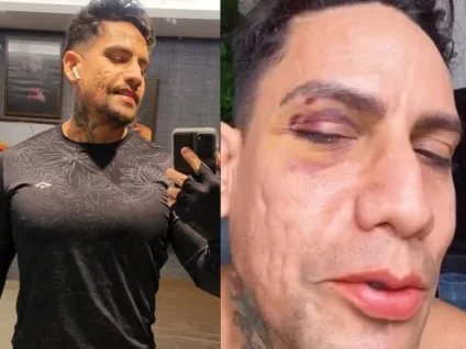 Arquiteto relata terror após ser agredido por se vestir como drag no Carnaval: 