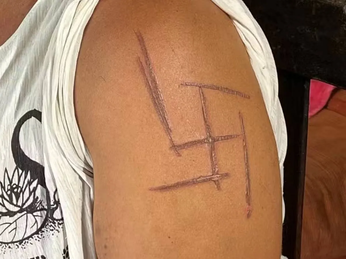 Mulher trans é vítima de tortura e ataque com símbolo nazista em MS