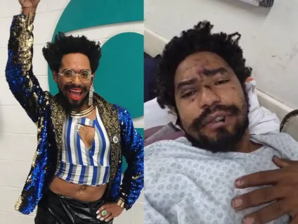 Ator denuncia homofobia e acaba hospitalizado após sofrer ataque em SP