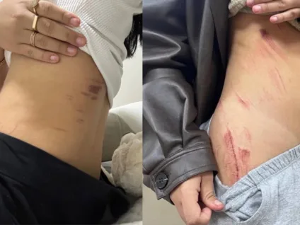 Casal lésbico é vítima de estupro após abordagem com faca por morador de rua no DF