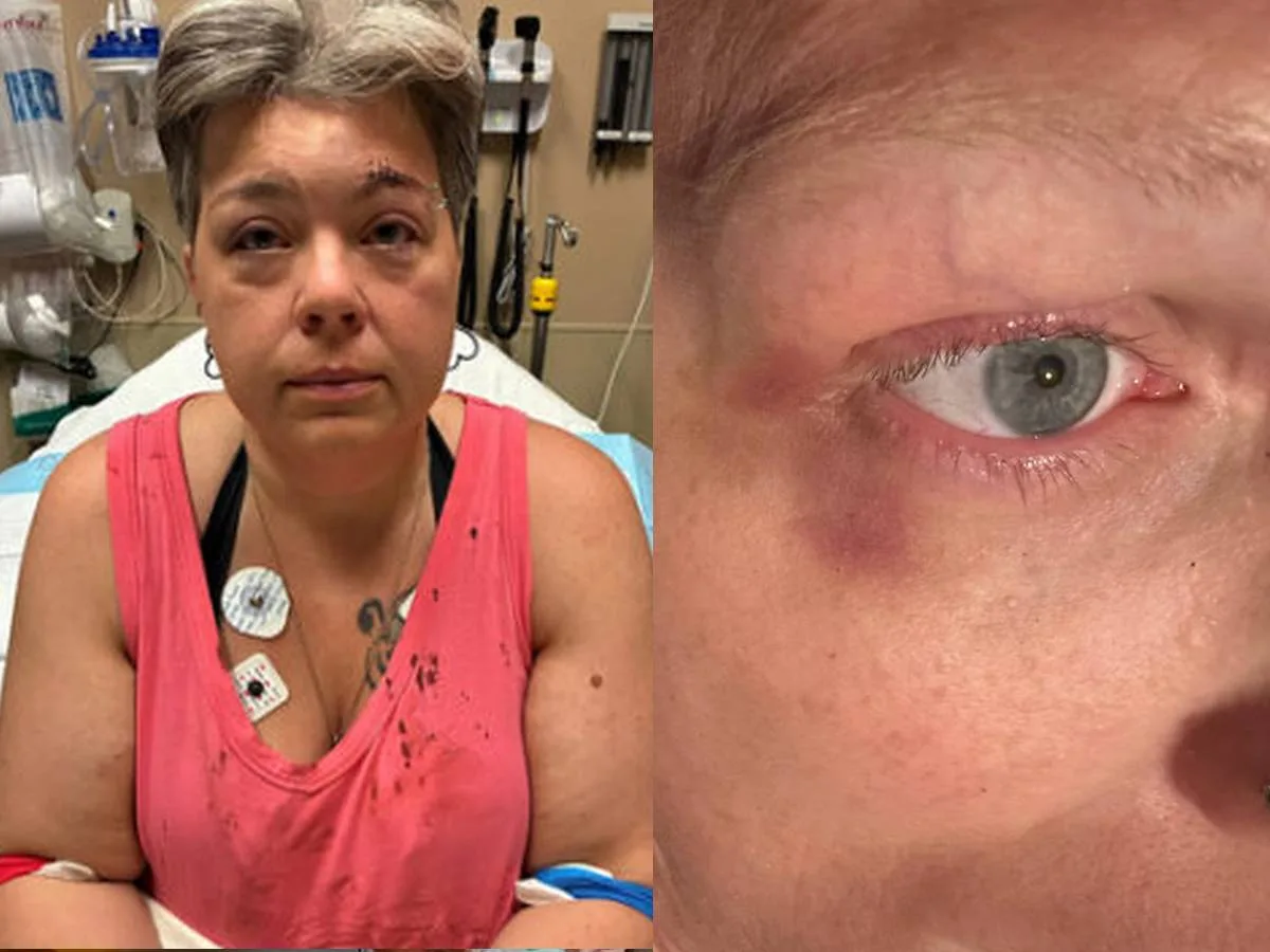 Casal trans é preso após ser brutalmente agredido por multidão ao usar banheiro público