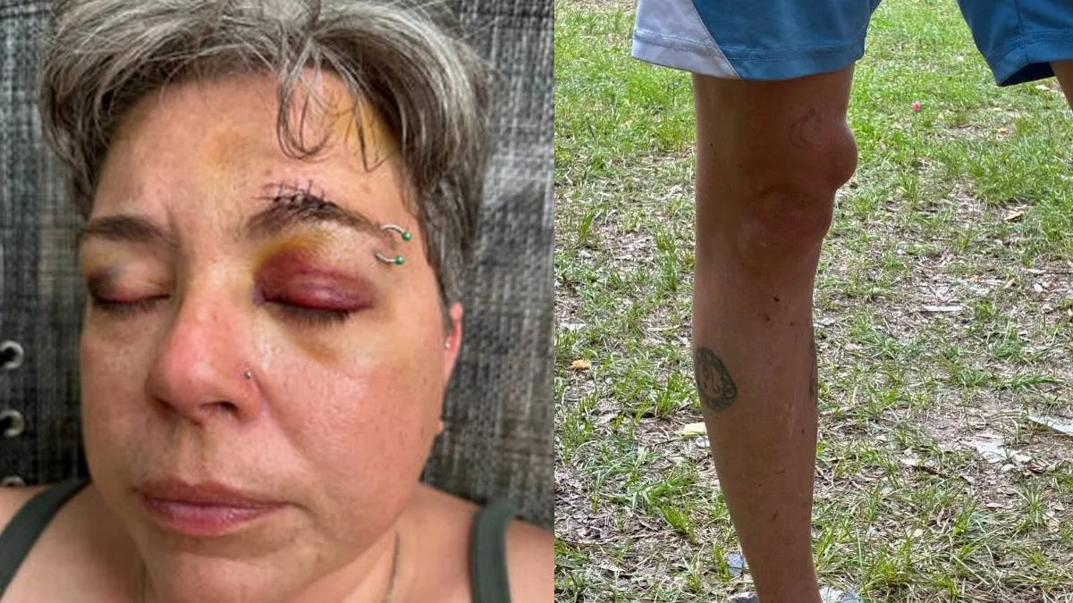 Casal trans é preso após ser brutalmente agredido por multidão ao usar banheiro público