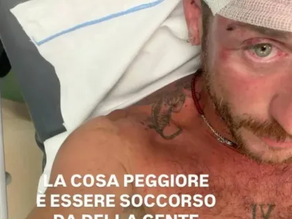 Promotor gay é espancado por grupo de 30 pessoas após evento LGBTQIA+