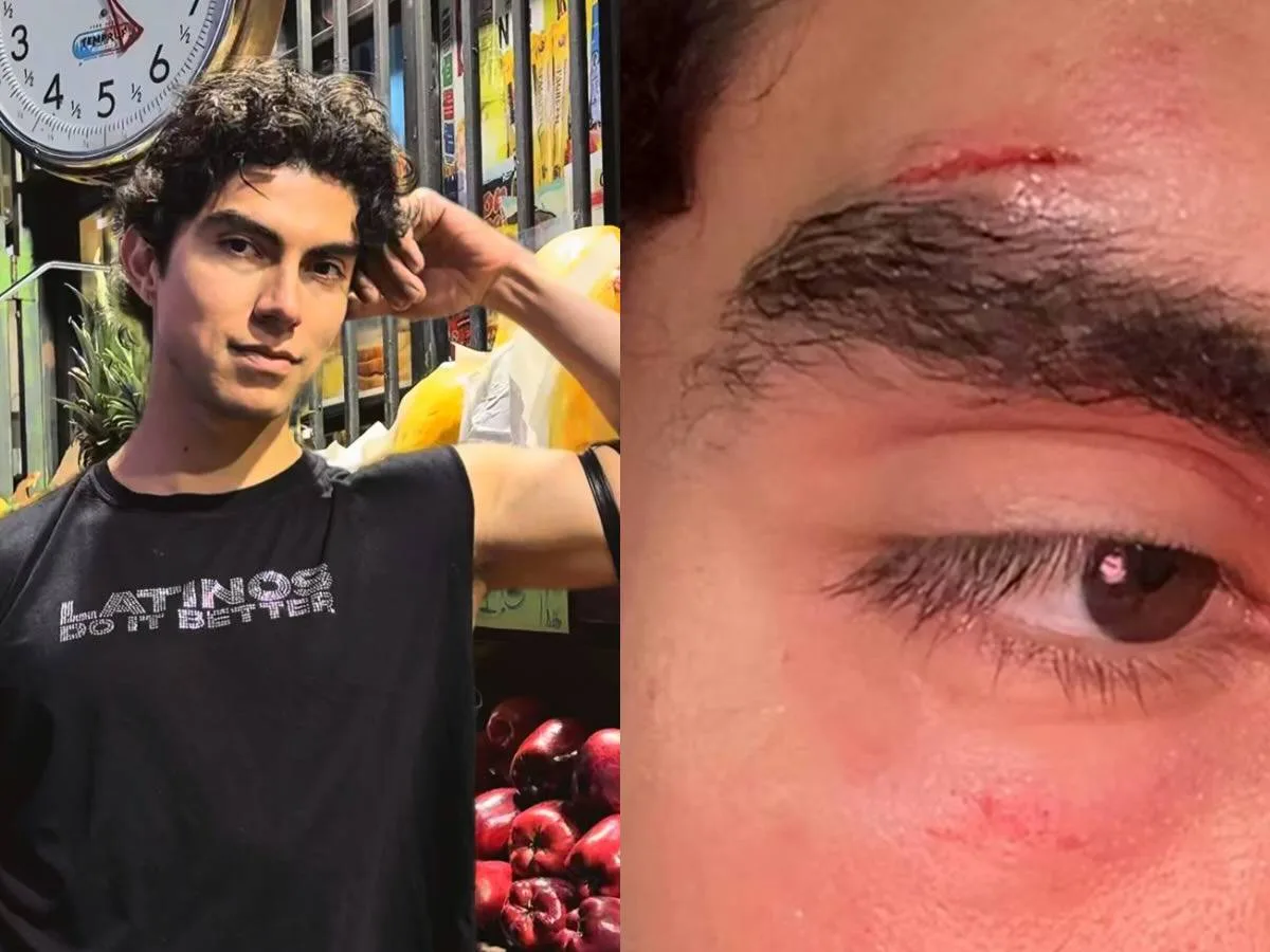 Ator de conteúdo adulto gay revela agressão após sair de bar LGBT+: "Estavam zombando do meu trabalho"